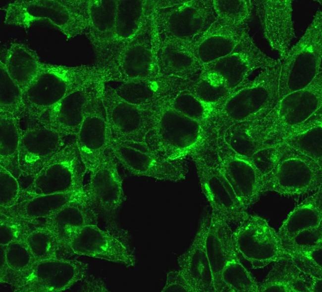 Beta-2 Microglobulin (Renal Failure and Tumor Marker) Antibody in Immunocytochemistry (ICC/IF)