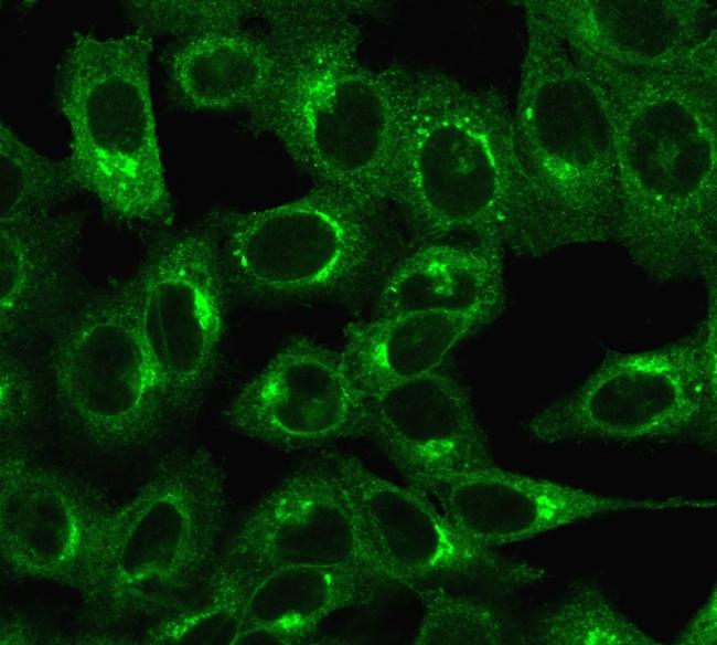 Beta-2 Microglobulin (Renal Failure and Tumor Marker) Antibody in Immunocytochemistry (ICC/IF)