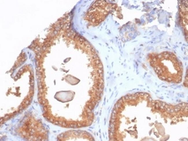 Beta-2 Microglobulin (Renal Failure and Tumor Marker) Antibody in Immunohistochemistry (Paraffin) (IHC (P))