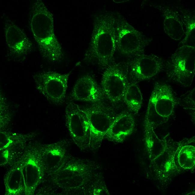 Beta-2 Microglobulin Antibody in Immunocytochemistry (ICC/IF)