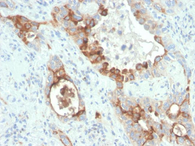 PMEPA1/TMEPAI (Tumor Suppressor Oncoprotein) Antibody in Immunohistochemistry (Paraffin) (IHC (P))