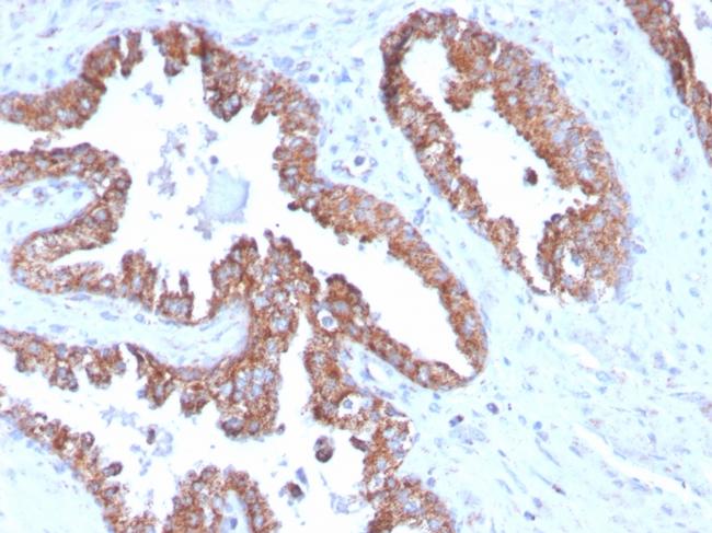 PMEPA1/TMEPAI (Tumor Suppressor Oncoprotein) Antibody in Immunohistochemistry (Paraffin) (IHC (P))