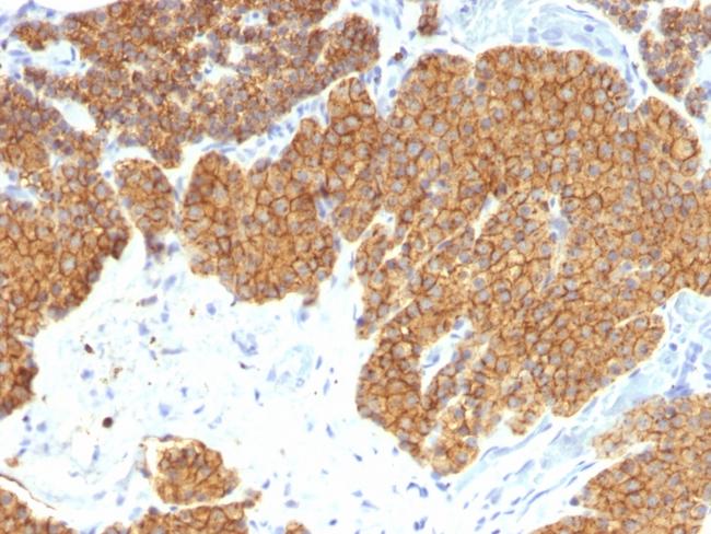 Parathyroid Hormone (PTH) Antibody in Immunohistochemistry (Paraffin) (IHC (P))