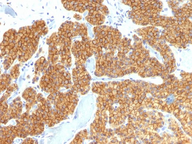 Parathyroid Hormone (PTH) Antibody in Immunohistochemistry (Paraffin) (IHC (P))