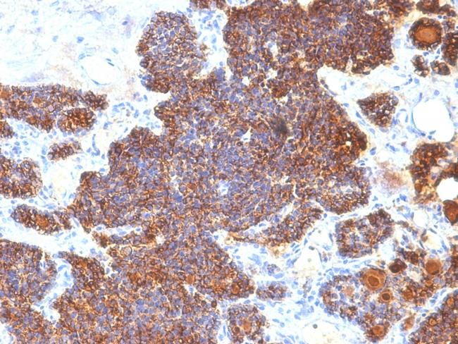 Parathyroid Hormone (PTH) Antibody in Immunohistochemistry (Paraffin) (IHC (P))