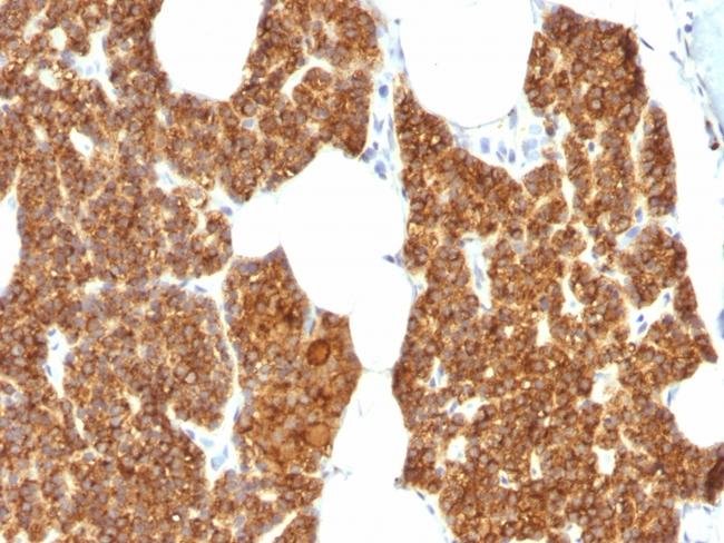 Parathyroid Hormone (PTH) Antibody in Immunohistochemistry (Paraffin) (IHC (P))