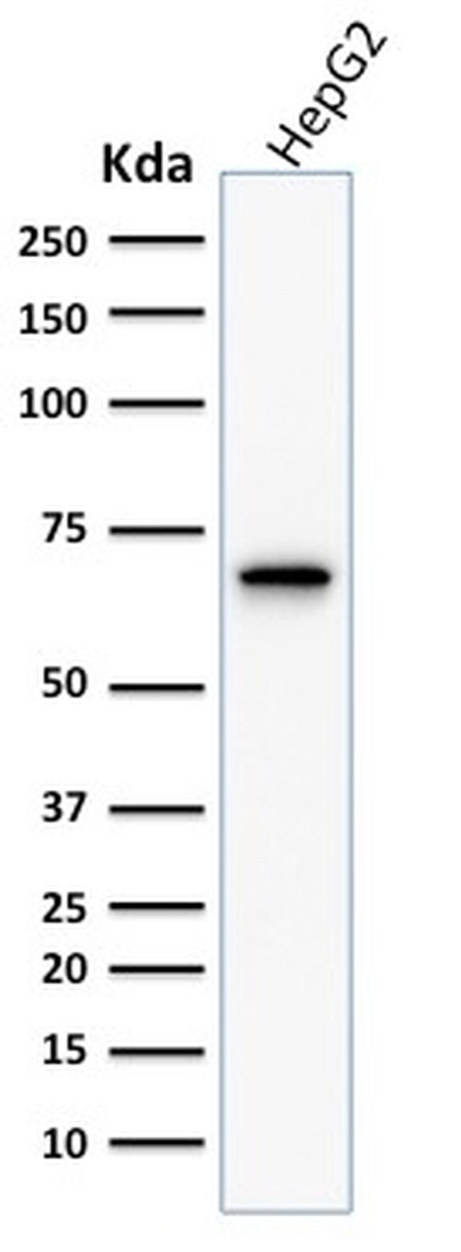 Cycloxygenase-2 (COX-2) Antibody in Western Blot (WB)