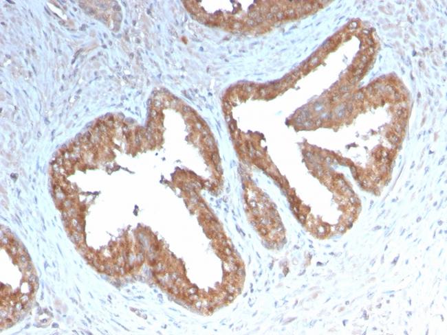 Cycloxygenase-2 (COX-2) Antibody in Immunohistochemistry (Paraffin) (IHC (P))