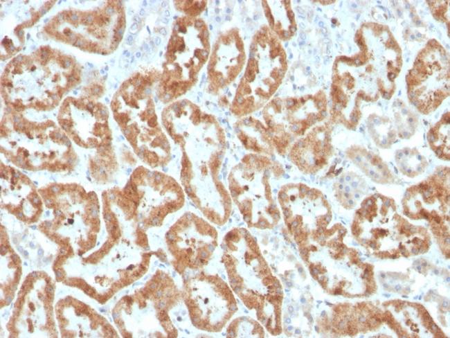 Cycloxygenase-2 (COX-2) Antibody in Immunohistochemistry (Paraffin) (IHC (P))