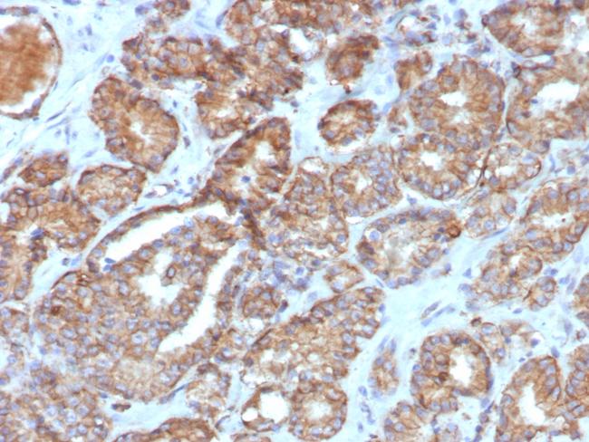 Cycloxygenase-2 (COX-2) Antibody in Immunohistochemistry (Paraffin) (IHC (P))