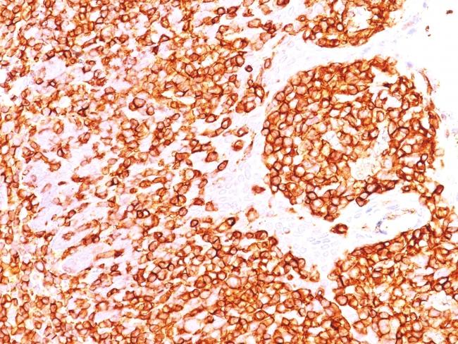 CD45RB (B-Cell Marker) Antibody in Immunohistochemistry (Paraffin) (IHC (P))