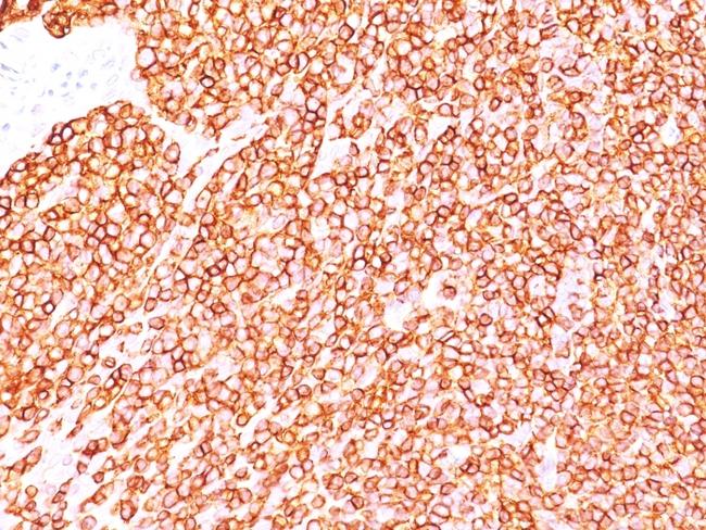 CD45RB (B-Cell Marker) Antibody in Immunohistochemistry (Paraffin) (IHC (P))