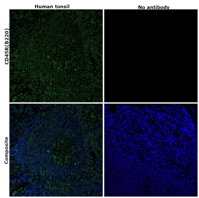 CD45R (B220) Antibody in Immunohistochemistry (Paraffin) (IHC (P))