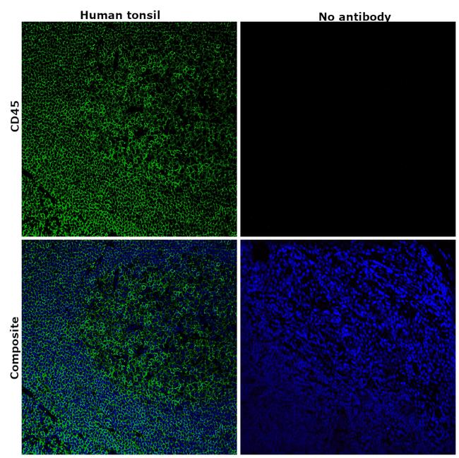 CD45 Antibody in Immunohistochemistry (Paraffin) (IHC (P))