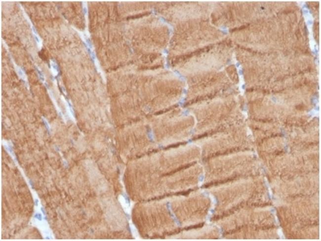 Actin alpha 1, Skeletal Muscle Antibody in Immunohistochemistry (Paraffin) (IHC (P))