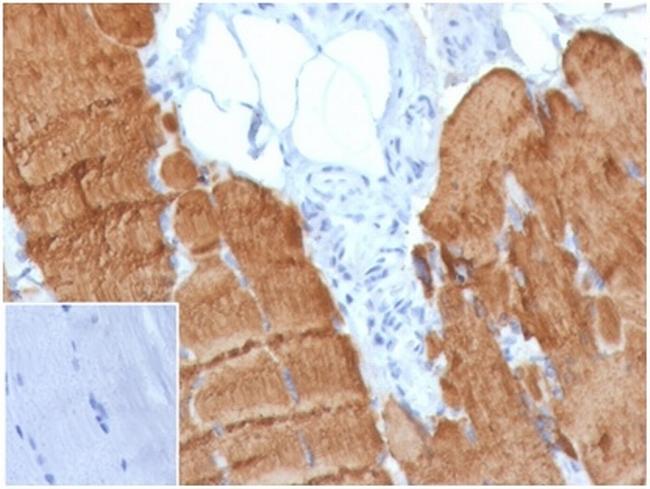 Actin alpha 1, Skeletal Muscle Antibody in Immunohistochemistry (Paraffin) (IHC (P))