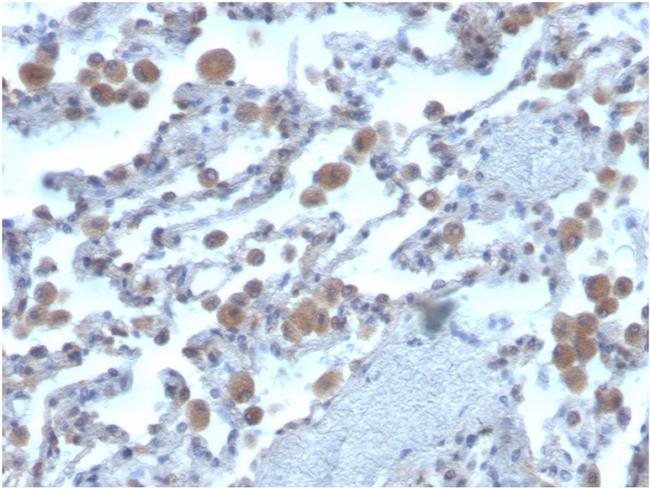 Ras-related C3 botulinum toxin substrate 1 Antibody in Immunohistochemistry (Paraffin) (IHC (P))