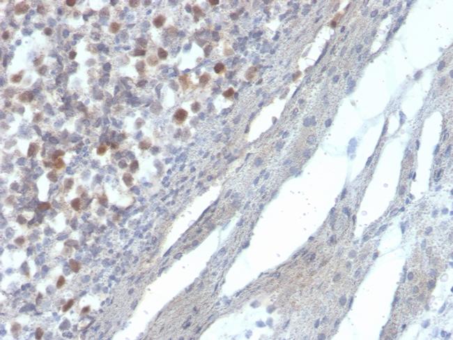 RAD51 Antibody in Immunohistochemistry (Paraffin) (IHC (P))