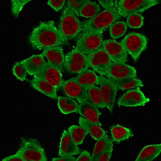 Actin, Smooth Muscle (Leiomyosarcoma Marker) Antibody in Immunocytochemistry (ICC/IF)