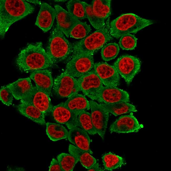 Actin, Smooth Muscle (Leiomyosarcoma Marker) Antibody in Immunocytochemistry (ICC/IF)