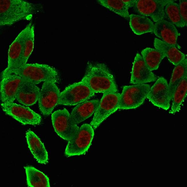 Actin, Smooth Muscle (Leiomyosarcoma Marker) Antibody in Immunocytochemistry (ICC/IF)