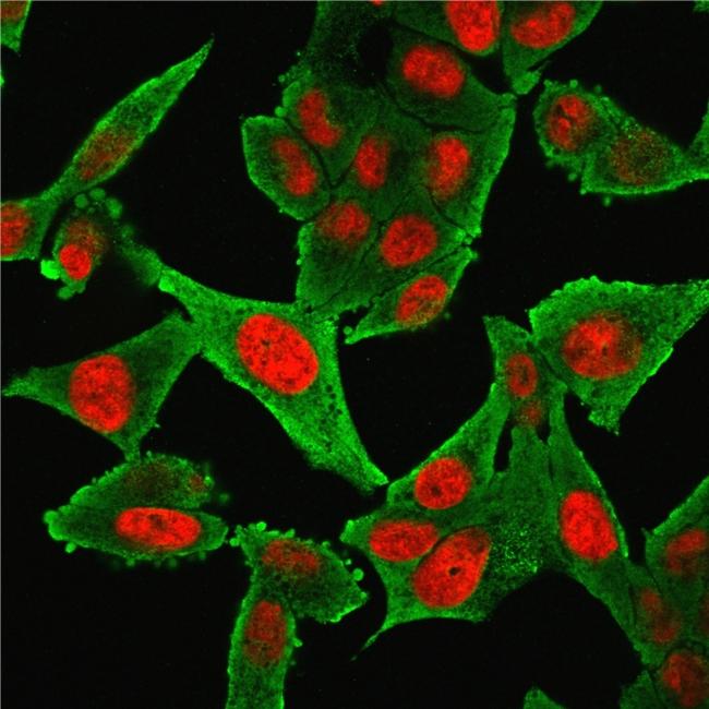 Actin, Smooth Muscle (Leiomyosarcoma Marker) Antibody in Immunocytochemistry (ICC/IF)