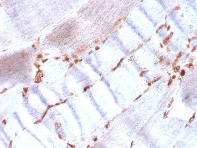 Actin, Smooth Muscle (Leiomyosarcoma Marker) Antibody in Immunohistochemistry (Paraffin) (IHC (P))