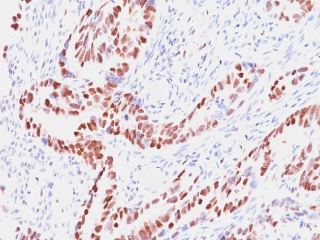 Rb1 (Tumor Suppressor Protein) Antibody in Immunohistochemistry (Paraffin) (IHC (P))