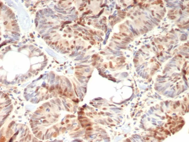 Rb1 (Tumor Suppressor Protein) Antibody in Immunohistochemistry (Paraffin) (IHC (P))