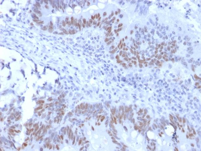 Rb1 (Tumor Suppressor Protein) Antibody in Immunohistochemistry (Paraffin) (IHC (P))