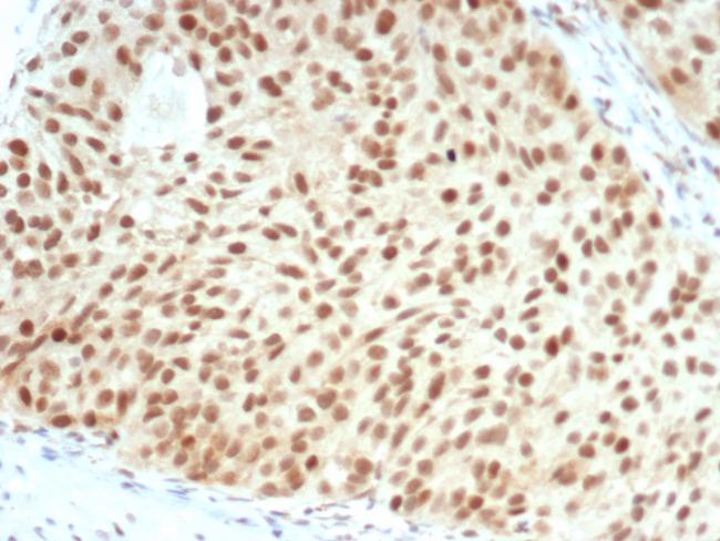 Rb1 (Tumor Suppressor Protein) Antibody in Immunohistochemistry (Paraffin) (IHC (P))