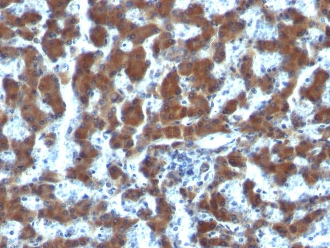 Retinol Binding Protein-1 (RBP1) Antibody in Immunohistochemistry (Paraffin) (IHC (P))