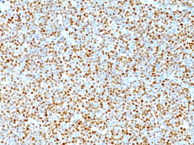 Cyclin D1 (G1-Cyclin and Mantle Cell Marker) Antibody in Immunohistochemistry (Paraffin) (IHC (P))