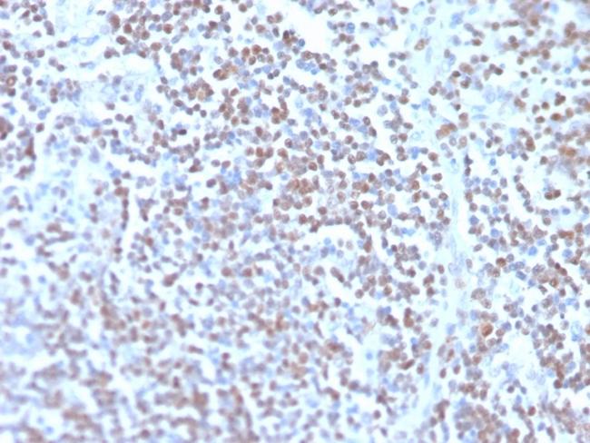 Cyclin D1 (G1-Cyclin and Mantle Cell Lymphoma Marker) Antibody in Immunohistochemistry (Paraffin) (IHC (P))