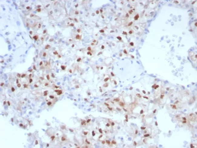 Cyclin D1 (G1-Cyclin and Mantle Cell Lymphoma Marker) Antibody in Immunohistochemistry (Paraffin) (IHC (P))