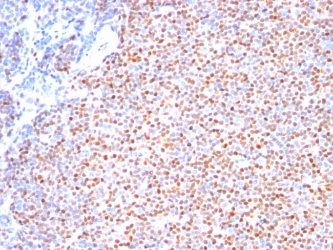 Cyclin D1 (G1-Cyclin and Mantle Cell Marker) Antibody in Immunohistochemistry (Paraffin) (IHC (P))