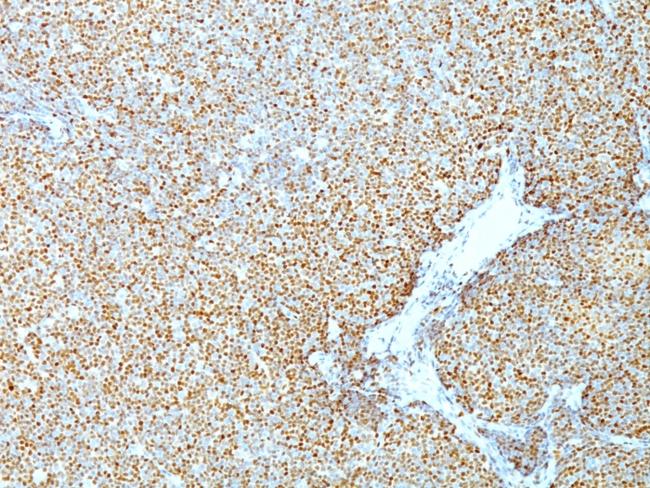 Cyclin D1 (G1-Cyclin and Mantle Cell Marker) Antibody in Immunohistochemistry (Paraffin) (IHC (P))