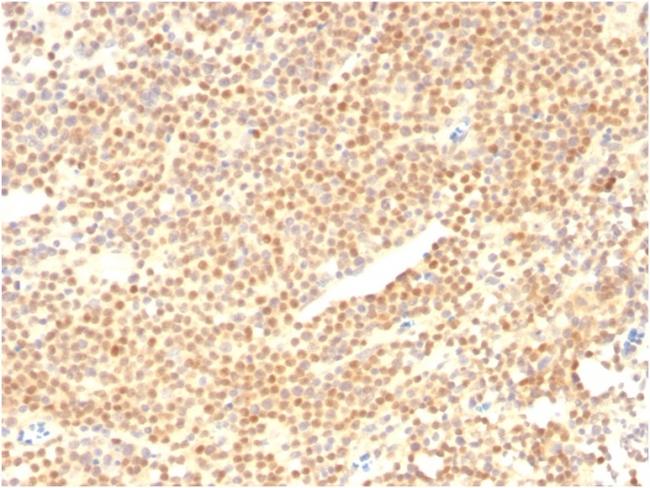 Cyclin D1 (G1-Cyclin and Mantle Cell Lymphoma Marker) Antibody in Immunohistochemistry (Paraffin) (IHC (P))