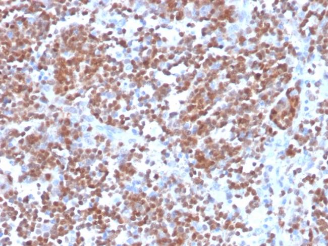 Cyclin D1 Antibody in Immunohistochemistry (Paraffin) (IHC (P))