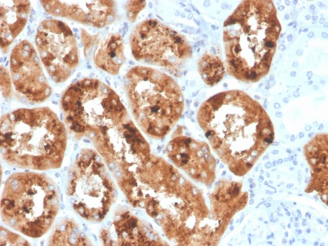 RBP4/Retinol Binding Protein 4 Antibody in Immunohistochemistry (Paraffin) (IHC (P))