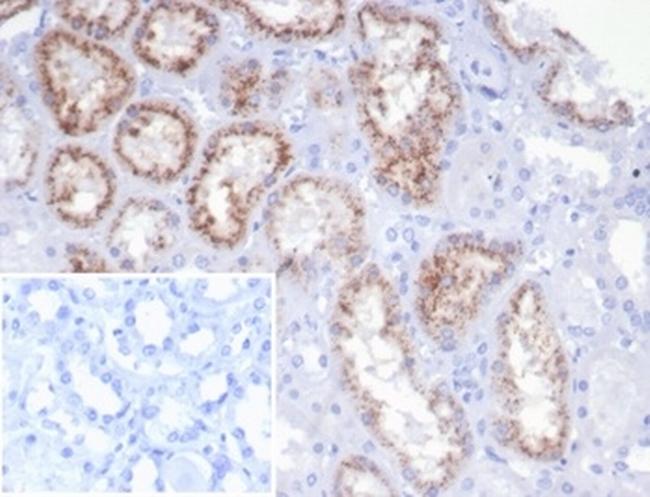 RBP4/Retinol Binding Protein 4 Antibody in Immunohistochemistry (Paraffin) (IHC (P))