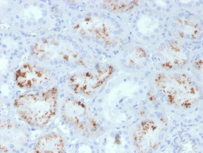 RBP4/Retinol Binding Protein 4 Antibody in Immunohistochemistry (Paraffin) (IHC (P))