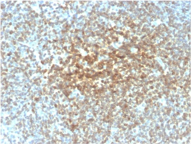 Bcl-2 Antibody in Immunohistochemistry (Paraffin) (IHC (P))