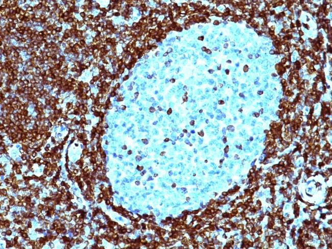 Bcl-2 (Apoptosis and Follicular Lymphoma Marker) Antibody in Immunohistochemistry (Paraffin) (IHC (P))