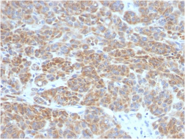 Bcl-2 (Apoptosis and Follicular Lymphoma Marker) Antibody in Immunohistochemistry (Paraffin) (IHC (P))