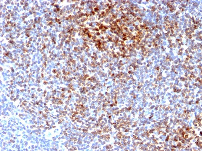 Bcl-2 Antibody in Immunohistochemistry (Paraffin) (IHC (P))