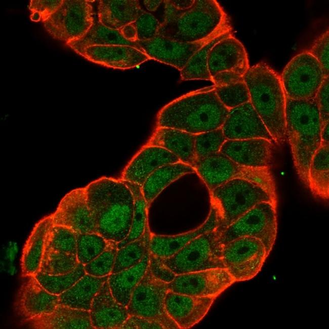 NF-kB p65/RELA Antibody in Immunocytochemistry (ICC/IF)