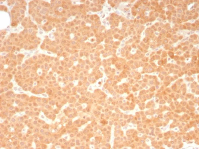 RET Proto-oncogene Antibody in Immunohistochemistry (Paraffin) (IHC (P))