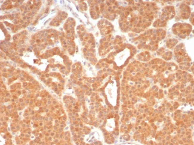 RET Proto-oncogene Antibody in Immunohistochemistry (Paraffin) (IHC (P))