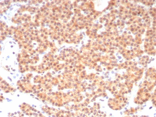 RET Proto-oncogene Antibody in Immunohistochemistry (Paraffin) (IHC (P))